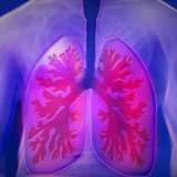 慢性閉塞性肺疾患（COPD）患者のスタチン使用は全死亡を減らしますか？
